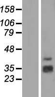 SH2D1B Human Over-expression Lysate