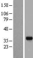 BSND Human Over-expression Lysate