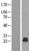 TSR2 Human Over-expression Lysate