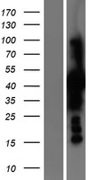 Phosphoserine Aminotransferase (PSAT1) Human Over-expression Lysate