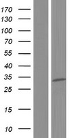 EXOSC6 Human Over-expression Lysate
