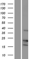 p16INK4A (CDKN2A) Human Over-expression Lysate