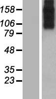 SLC8A3 Human Over-expression Lysate