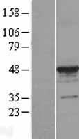 alpha Tubulin (TUBA3C) Human Over-expression Lysate
