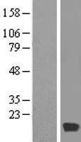 Myosin (MYL6) Human Over-expression Lysate