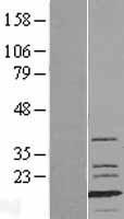 myosin light chain 1 (MYL1) Human Over-expression Lysate