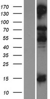 Collagen IX (COL9A1) Human Over-expression Lysate