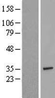 TCEAL2 Human Over-expression Lysate
