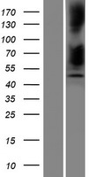 SERPINB12 Human Over-expression Lysate