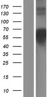 COLQ Human Over-expression Lysate