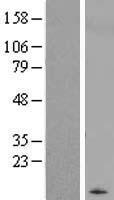 WFDC10A Human Over-expression Lysate