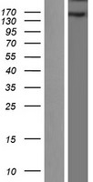 WHSC1 Human Over-expression Lysate