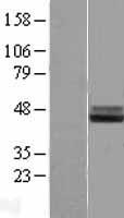 IL1RAP Human Over-expression Lysate