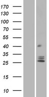 TMEM129 Human Over-expression Lysate
