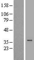 DHRS1 Human Over-expression Lysate