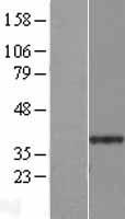 C6orf72 (GINM1) Human Over-expression Lysate