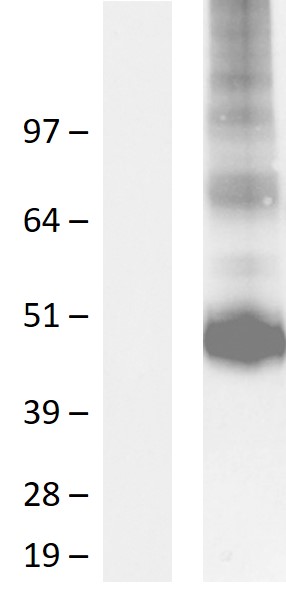 CD200R (CD200R1) Human Over-expression Lysate