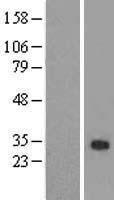 ZFAND2B Human Over-expression Lysate
