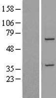 DDX31 Human Over-expression Lysate
