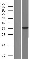 p38 (MAPK14) Human Over-expression Lysate