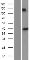HFE Human Over-expression Lysate