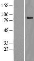 YY1AP1 Human Over-expression Lysate