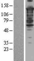 SMRC2 (SMARCC2) Human Over-expression Lysate