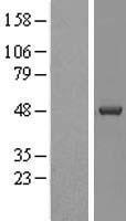 Casein Kinase 1 delta (CSNK1D) Human Over-expression Lysate