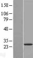 LYPLAL1 Human Over-expression Lysate