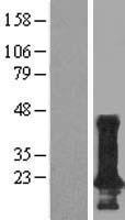 TMEM190 Human Over-expression Lysate