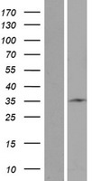 STARD6 Human Over-expression Lysate