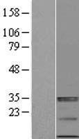 ULBP4 (RAET1E) Human Over-expression Lysate
