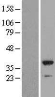 NFKBID Human Over-expression Lysate