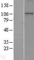 WDR36 Human Over-expression Lysate