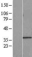START domain containing 7 (STARD7) Human Over-expression Lysate