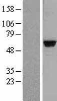MATK Human Over-expression Lysate