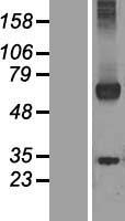 WDR20 Human Over-expression Lysate