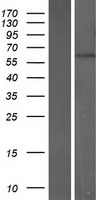 CNO6L (CNOT6L) Human Over-expression Lysate