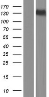 SPOCD1 Human Over-expression Lysate