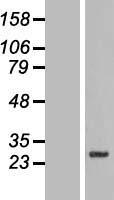SLC39A3 Human Over-expression Lysate