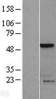 SLAIN1 Human Over-expression Lysate