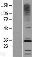 CMTM2 Human Over-expression Lysate