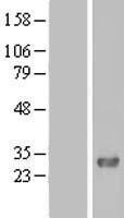 PHETA1 Human Over-expression Lysate