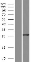 C11orf40 Human Over-expression Lysate