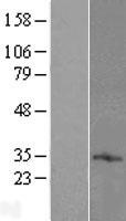 TMEM71 Human Over-expression Lysate