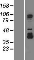 CCDC52 (SPICE1) Human Over-expression Lysate