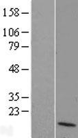 DUSP10 Human Over-expression Lysate