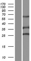 Sperm Flagellar 2 (SPEF2) Human Over-expression Lysate