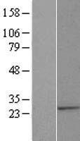 ALG14 Human Over-expression Lysate