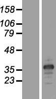MARCHF8 Human Over-expression Lysate